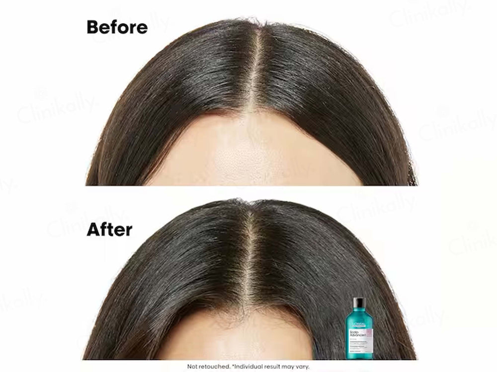 L'Oréal Professionnel Scalp Advanced Anti-Discomfort Dermo-Regulator Shampoo