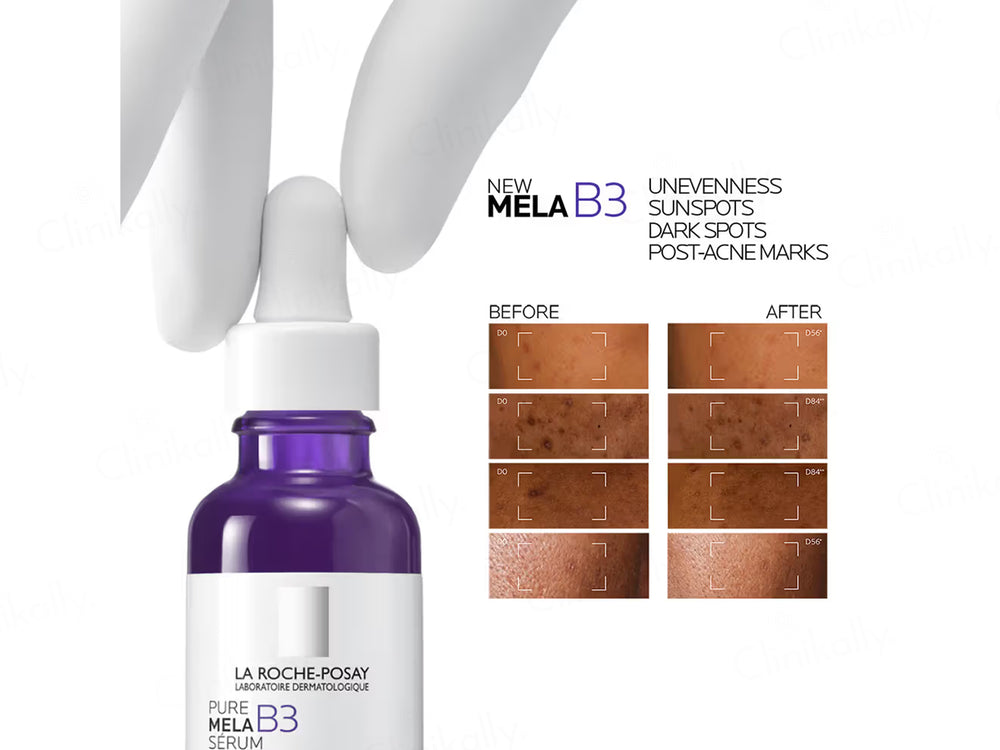 La Roche-Posay Mela B3 Anti-Dark Spots Serum