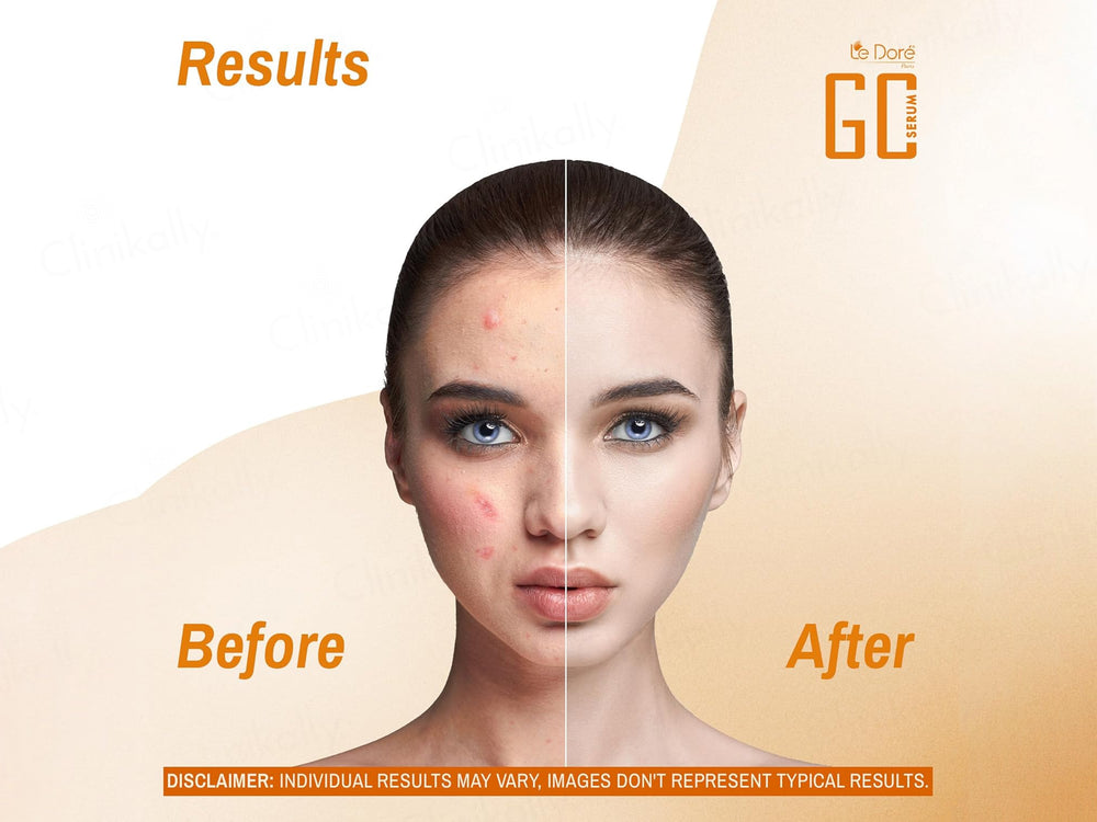 Le Dore GC 5X Vitamin C Liposomal Whitening & Anti Ageing Serum