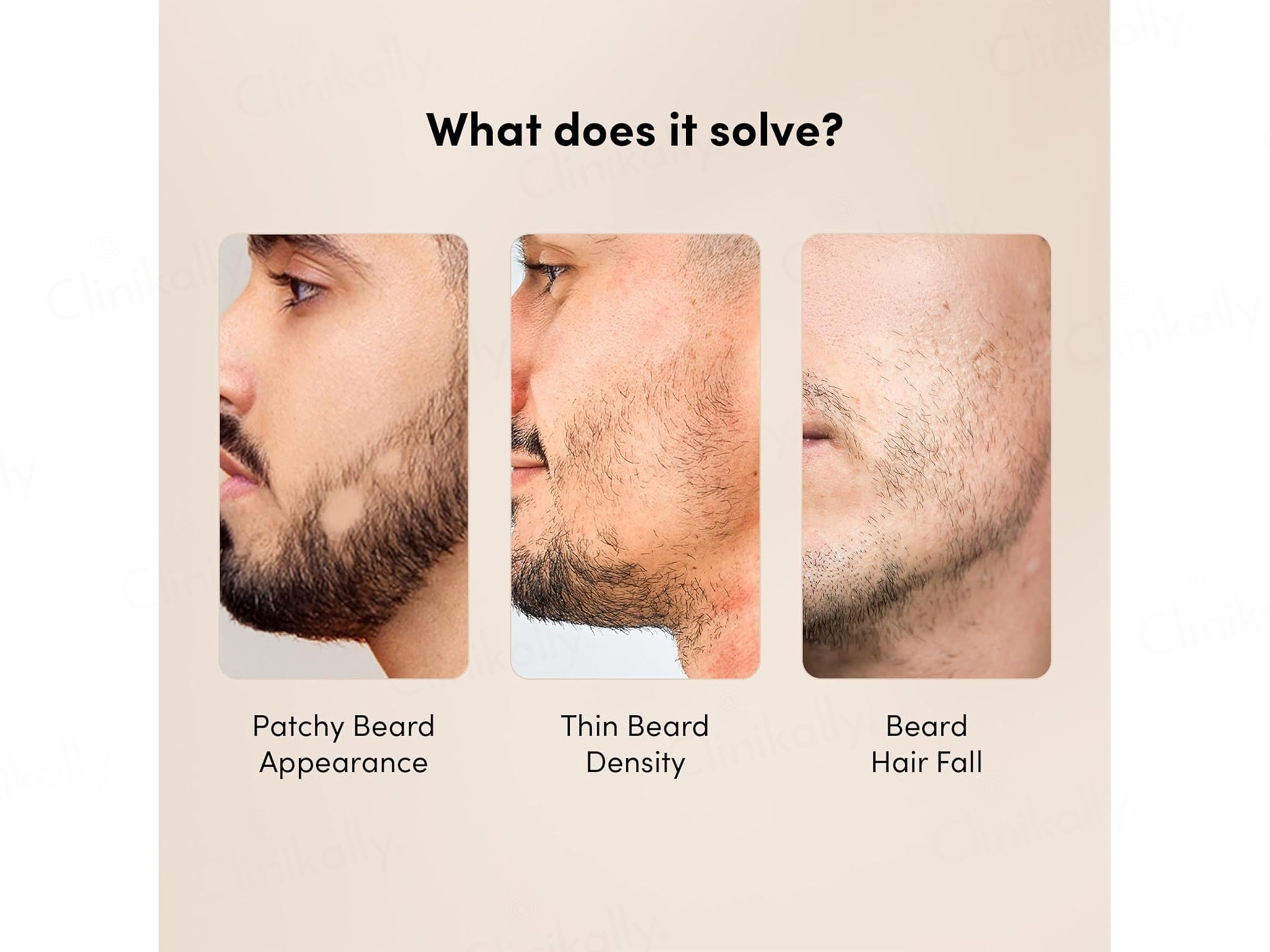 Man Matters Beardgro Serum For Beard