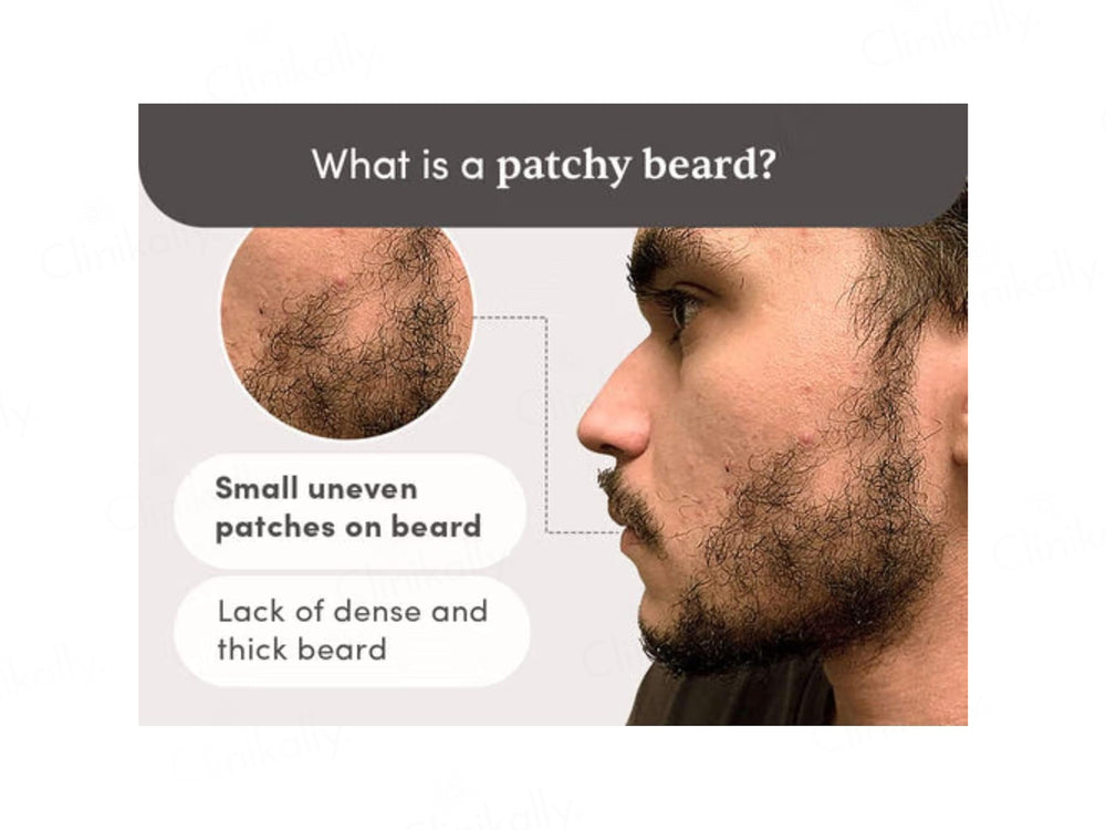 Man Matters Beardmax Growth Serum For Beard