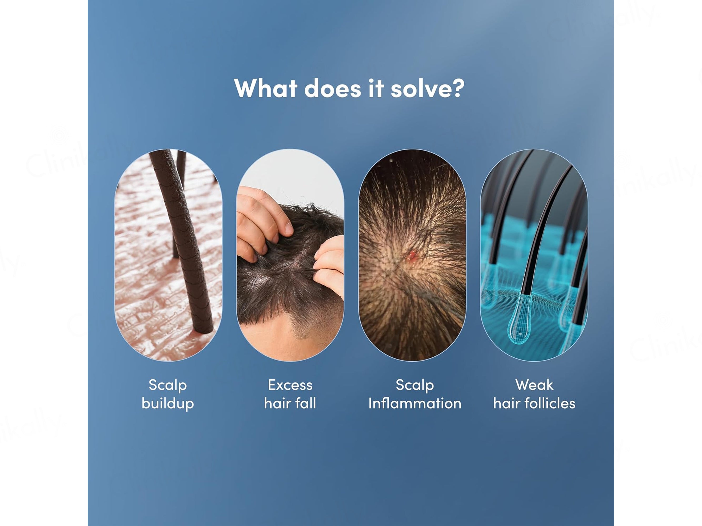 Man Matters DHT Blocking Anti Hair Fall Shampoo