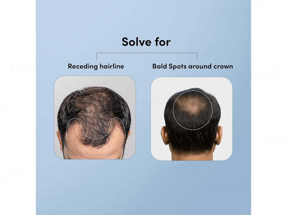Man Matters Minoxifin Advance Hair Topical Solution