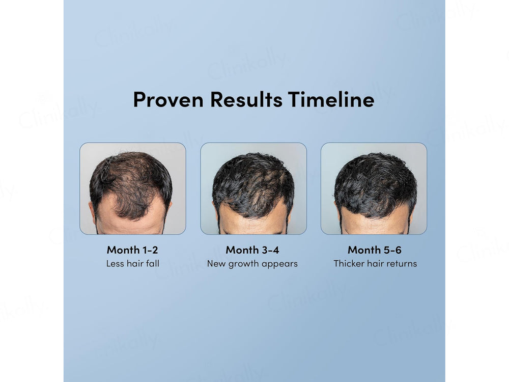 Man Matters Minoxifin Advance Hair Topical Solution
