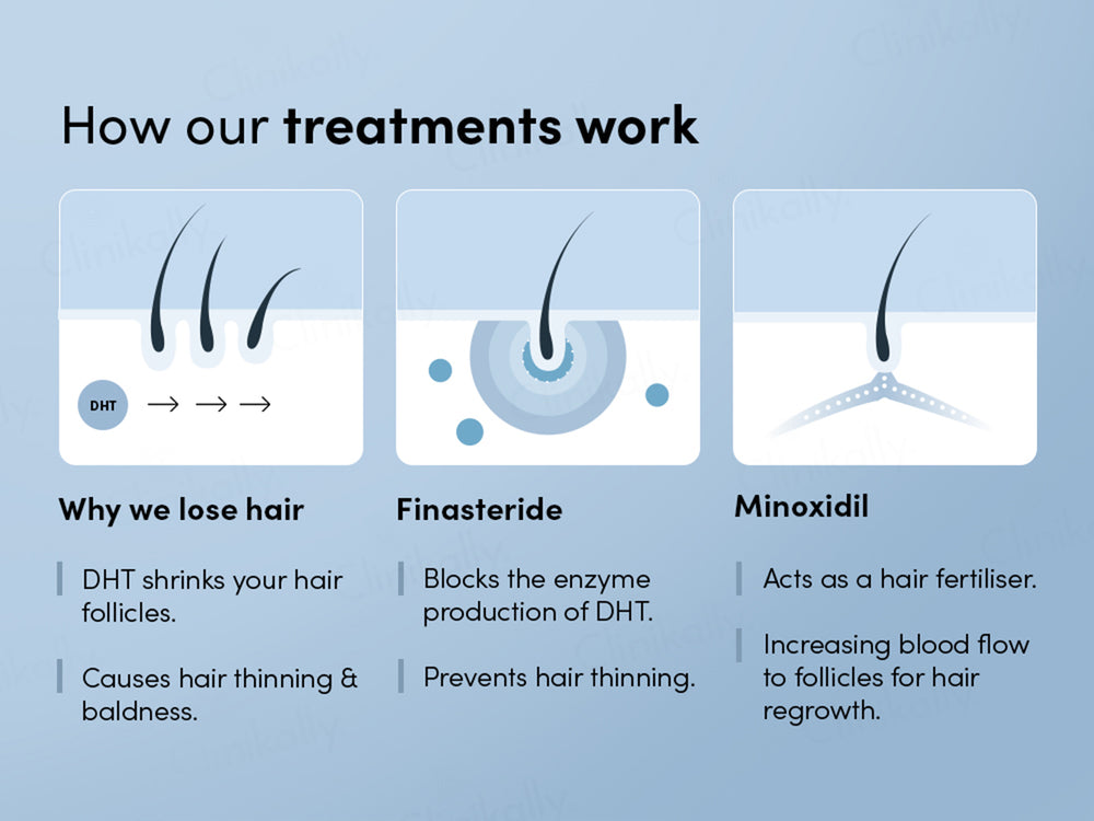 Man Matters Minoxifin Hair Topical Solution
