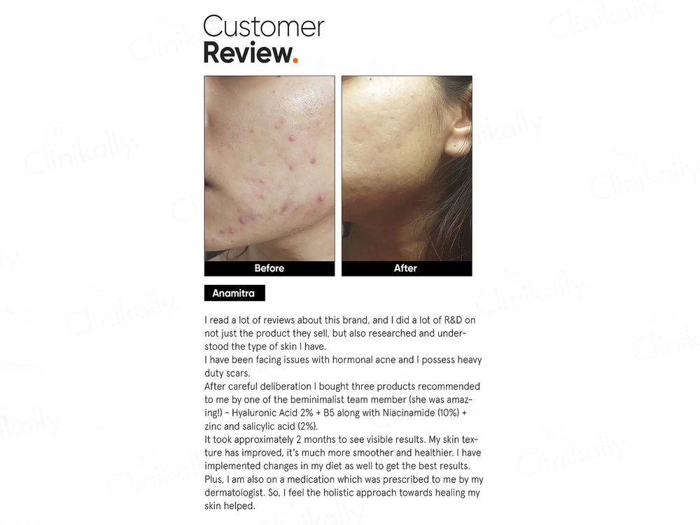 Minimalist 2% Hyaluronic Acid + PGA Face Serum