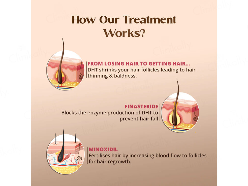 Minoxytop F5% Topical Solution