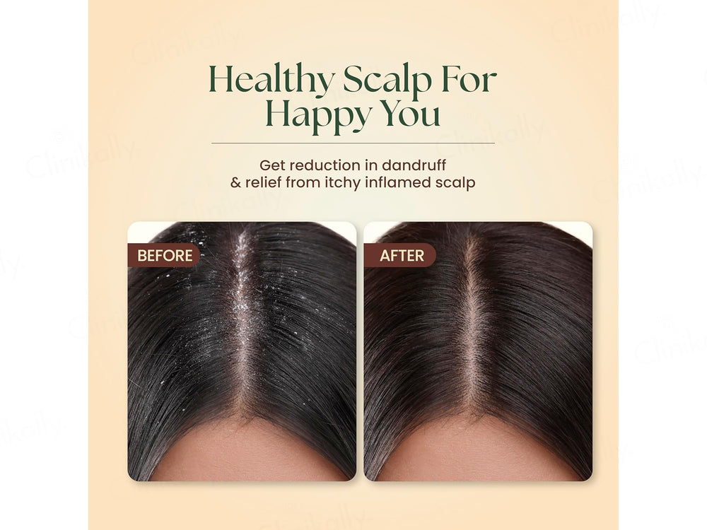 Moha: Neem & Hibiscus Anti-Dandruff Shampoo