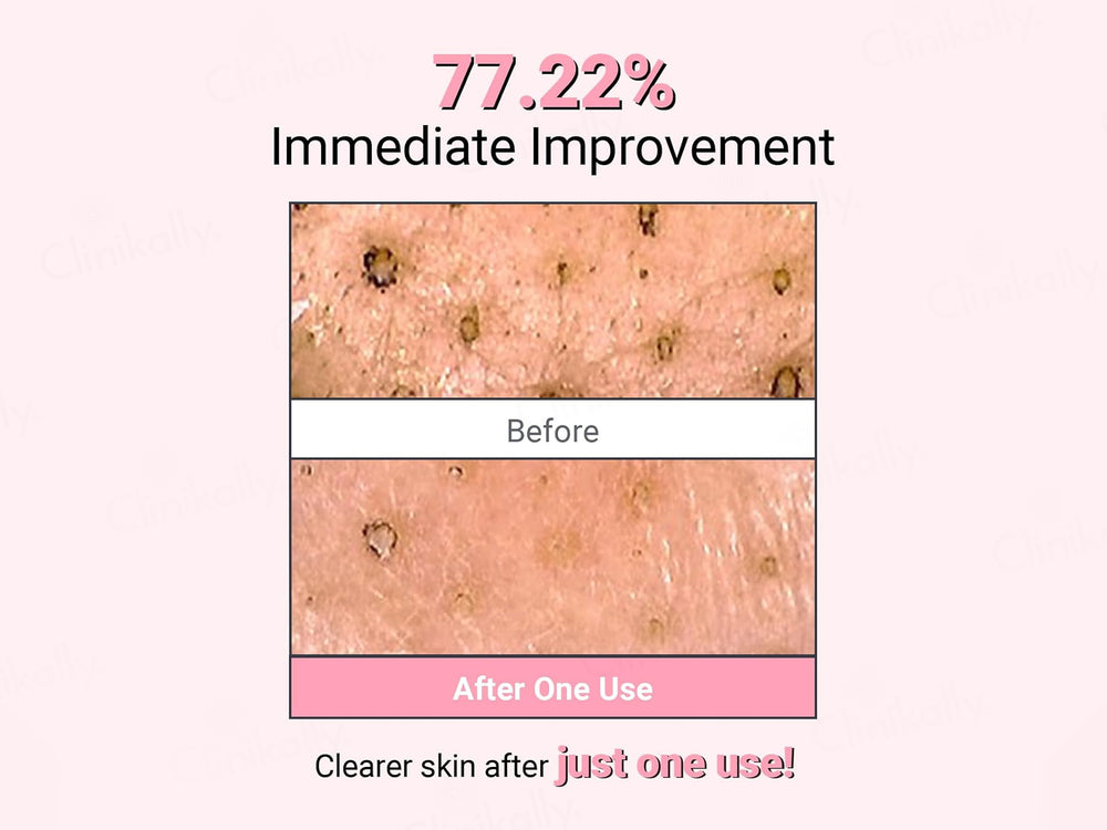 Neaf Neaf Kaolin Purifying Wash Off Mask