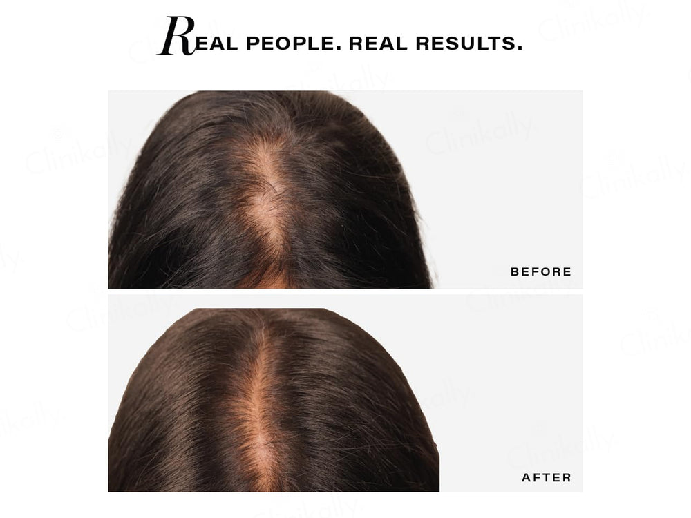 Novology Follicle Revive Hair Growth Scalp Serum