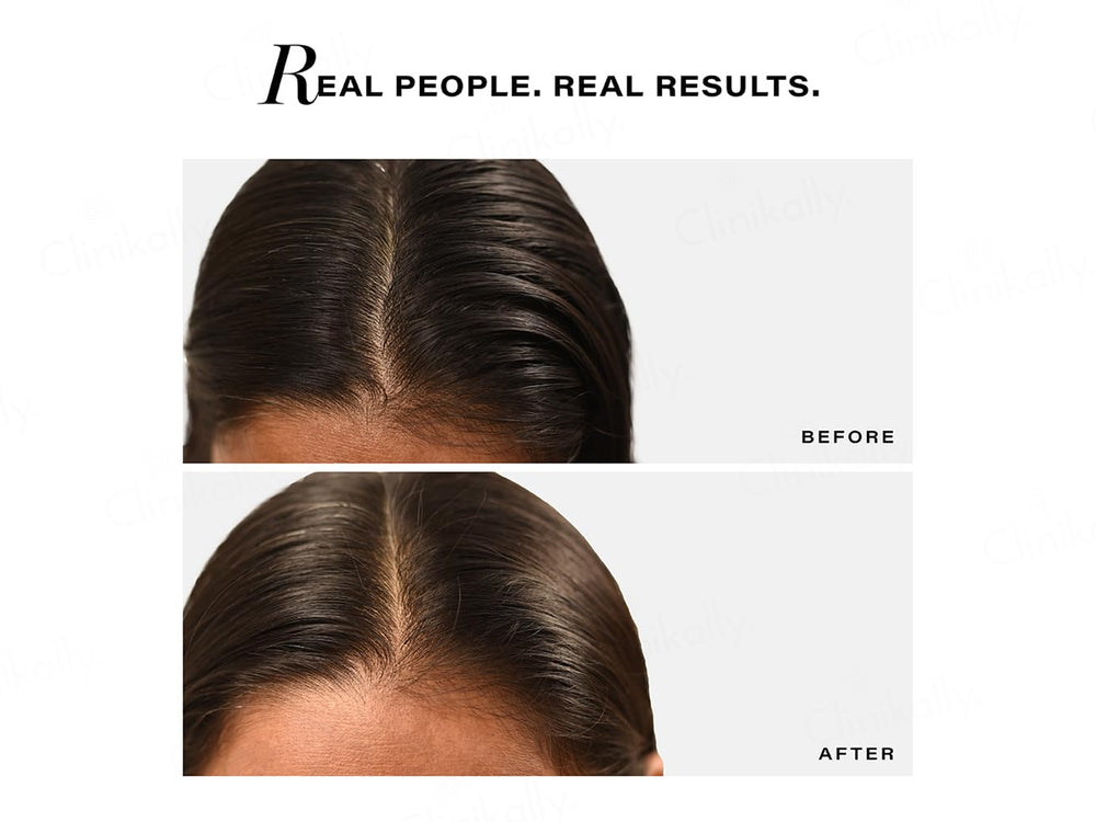 Novology Sebosys Control Scalp Serum For Oily Scalp