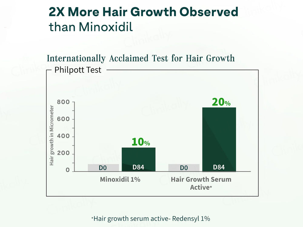 OZiva Advanced Hair Growth Serum