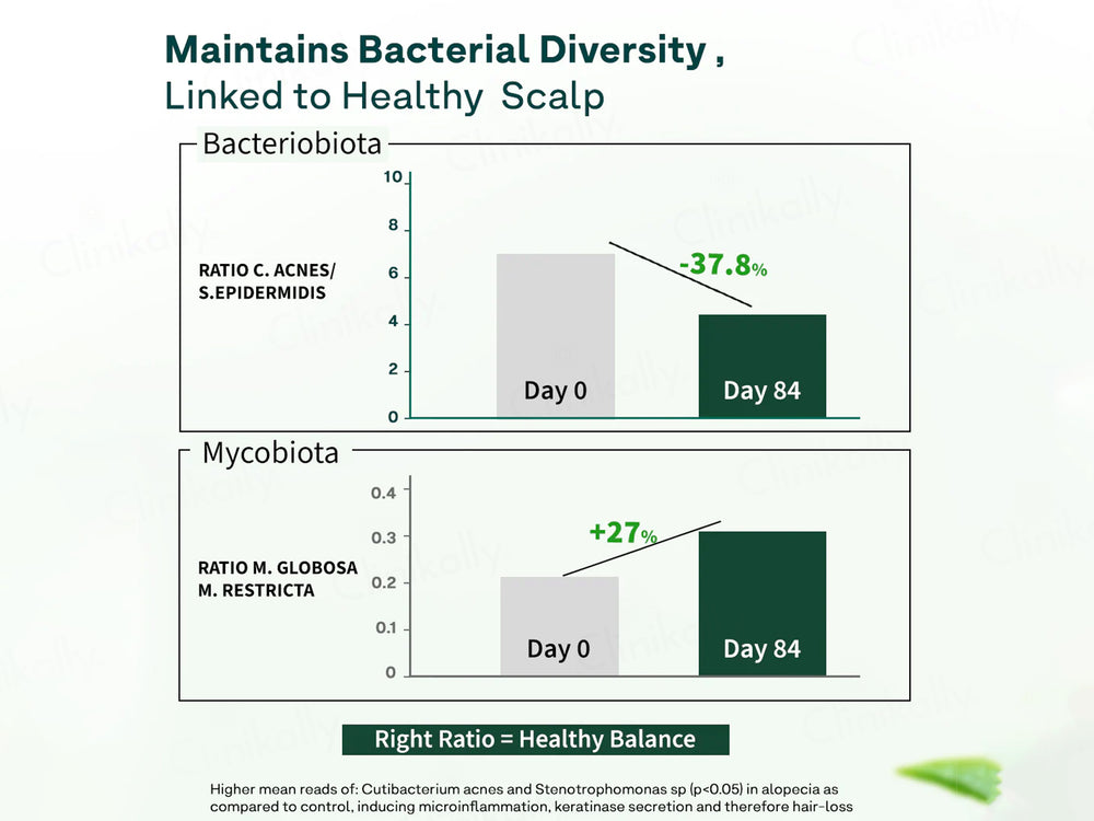 OZiva Advanced Hair Growth Serum