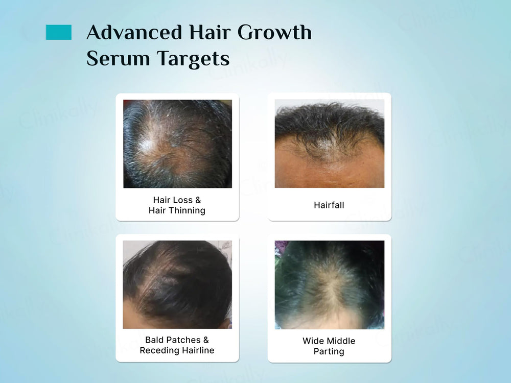 Pilgrim 3% Redensyl & 4% Anagain Advanced Hair Growth Serum With Korean Black Rice