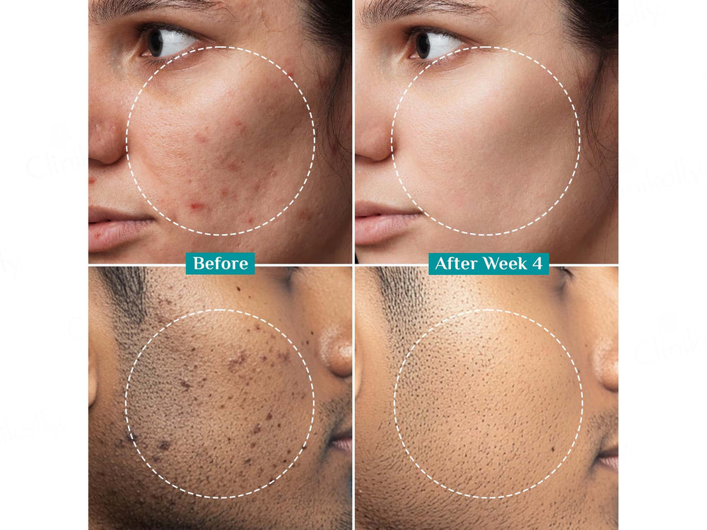 Pilgrim Alpha Arbutin & Vitamin C Brightening Serum