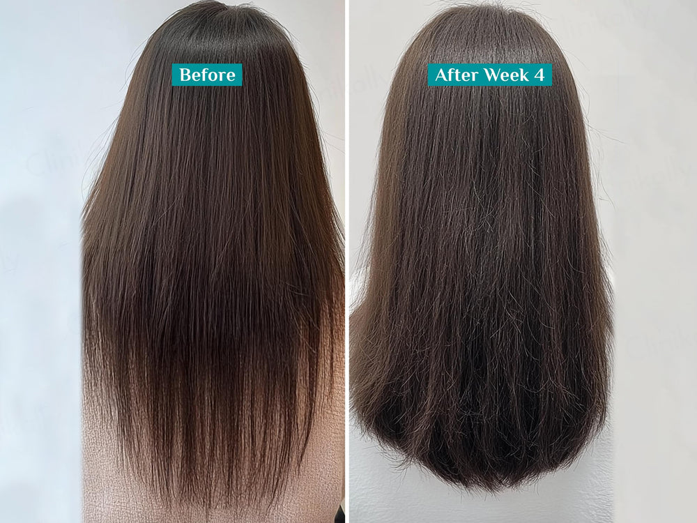 Pilgrim Redensyl & Anagain Hairfall Control Shampoo With Korean Black Rice