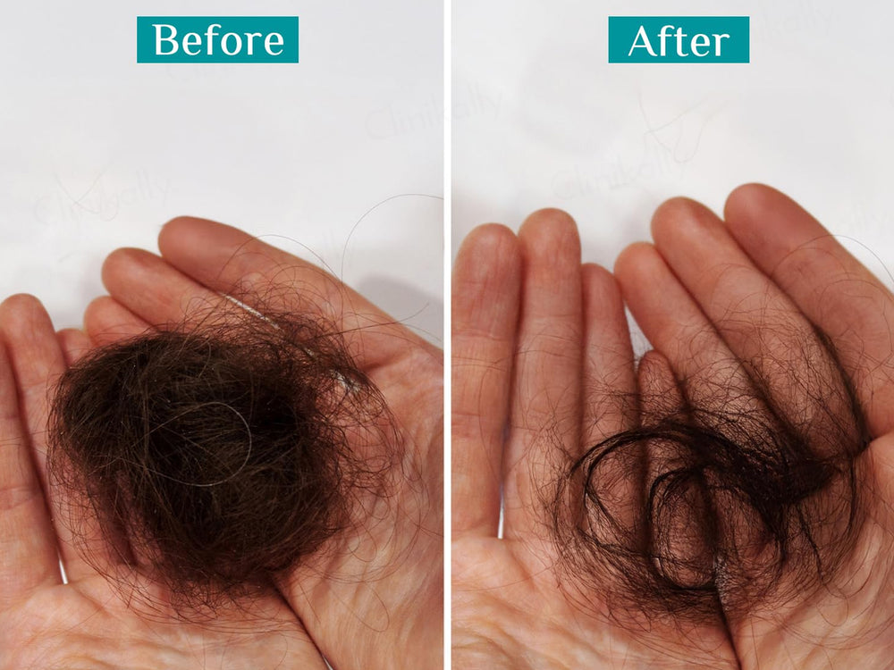 Pilgrim Redensyl & Anagain Hairfall Control Shampoo With Korean Black Rice