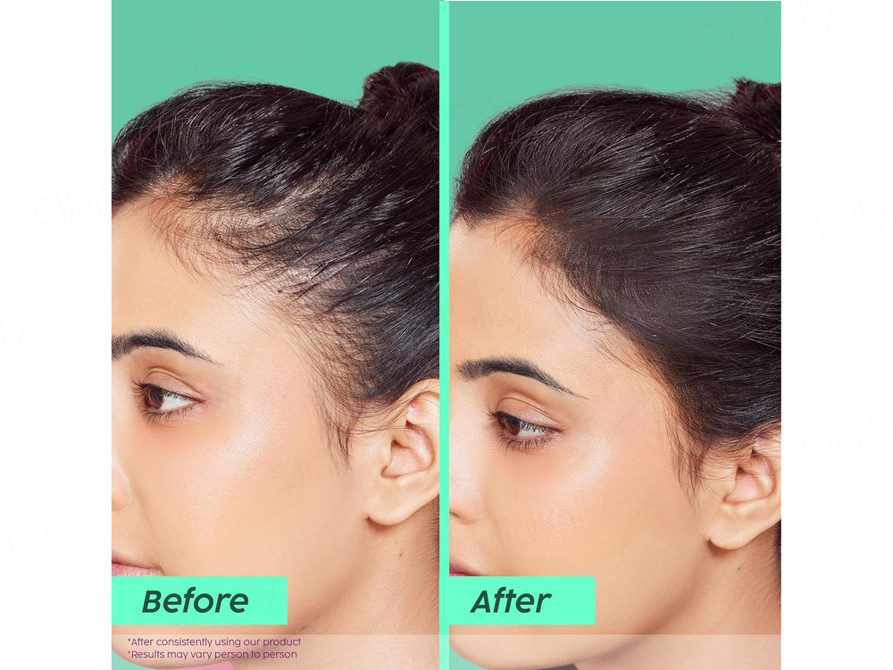 Plix Rosemary Anti-Hair Fall Advancved Shampoo