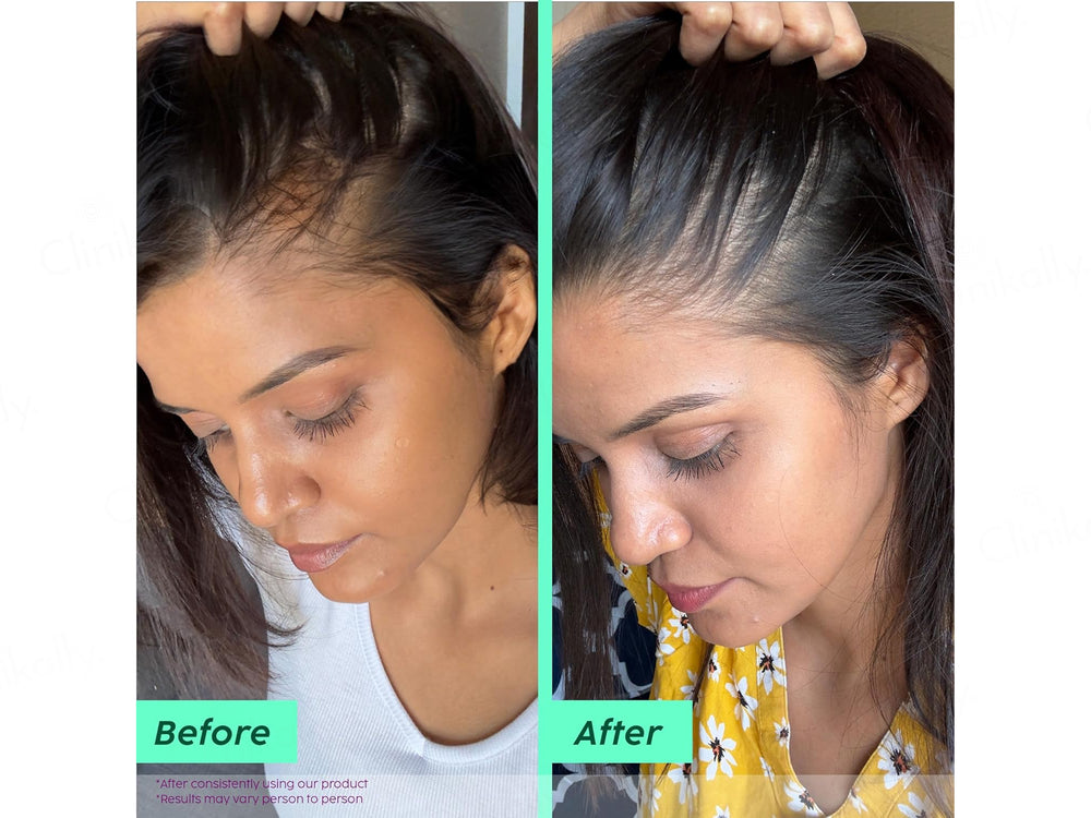 Plix Rosemary Anti-Hair Fall Advancved Shampoo