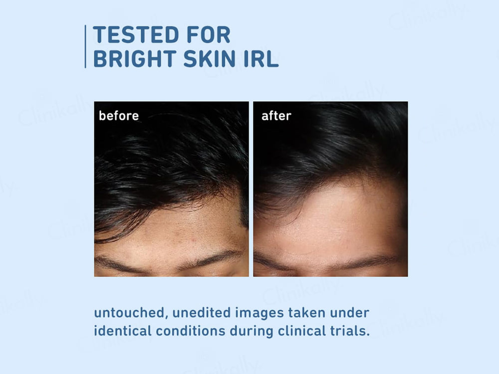 Plum 10% Niacinamide Clarity Boost Face Serum With Rice Water