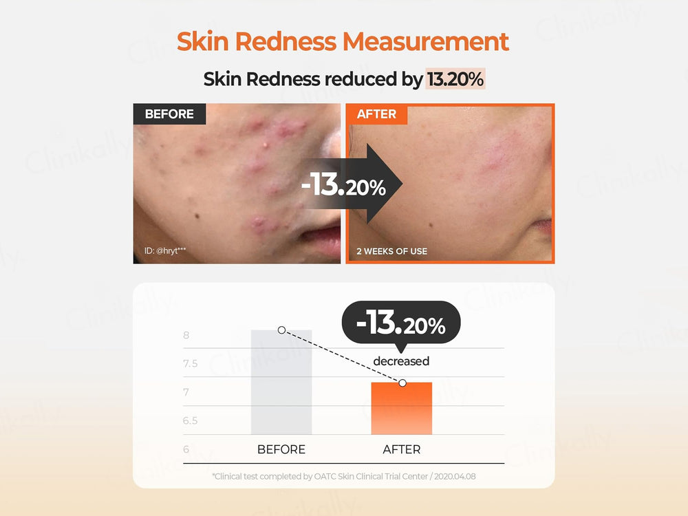 SKINFOOD Carrot Carotene Calming Water Pad