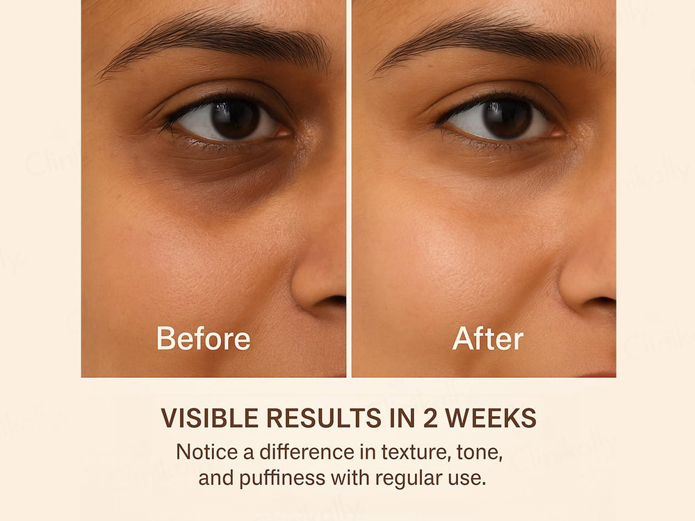 SKOG FER Under Eye Repair Oil