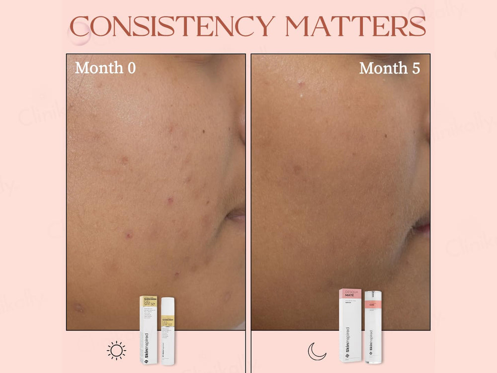 SkinInspired Desqua Mate AHA BHA PHA Face Serum