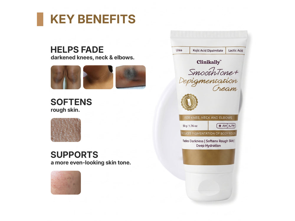 Clinikally SmoothTone+ Depigmentation Cream For Knee, Neck & Elbows