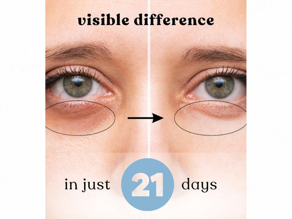 The CuraTeam Ezyroll Rejuvenating Under Eye Serum