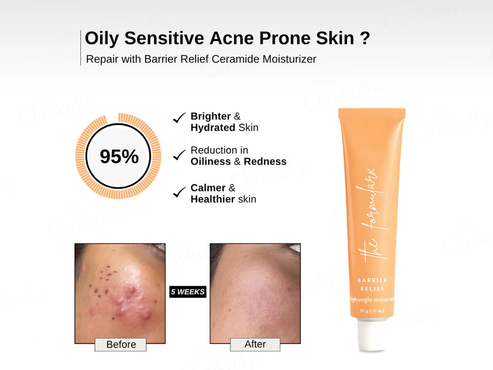 The FormulaRx Barrier Relief Lightweight Ceramide Moisturizer