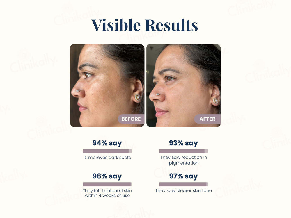 Uniqaya Retinol Serum