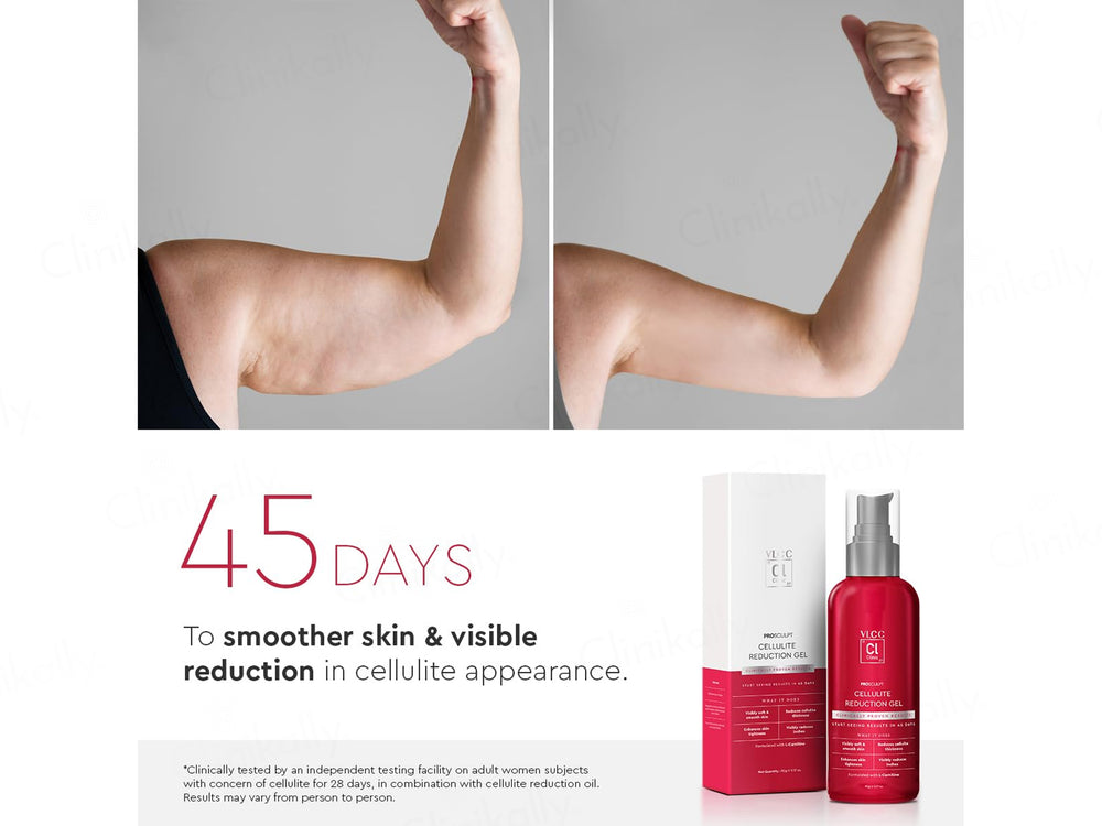 VLCC Clinic Prosculpt Cellulite Reduction Gel