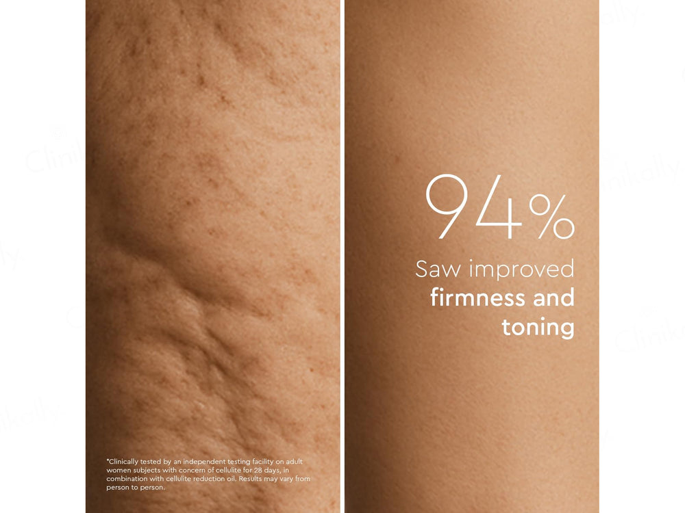 VLCC Clinic Prosculpt Cellulite Reduction Gel