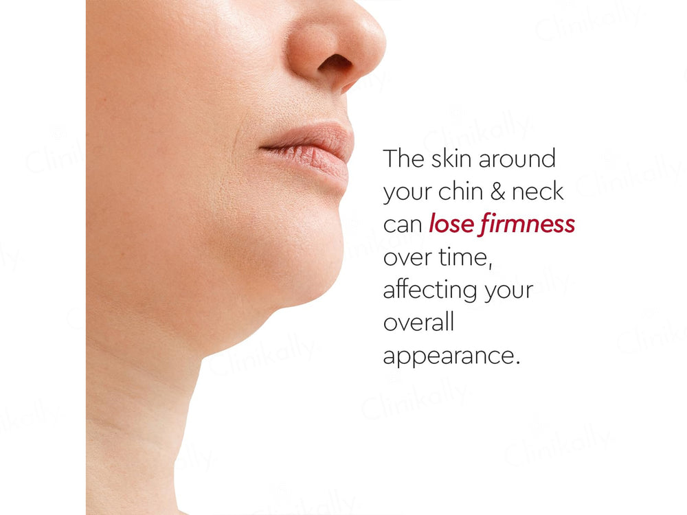VLCC Clinic Prosculpt Chin & Neck Line Firming Cream