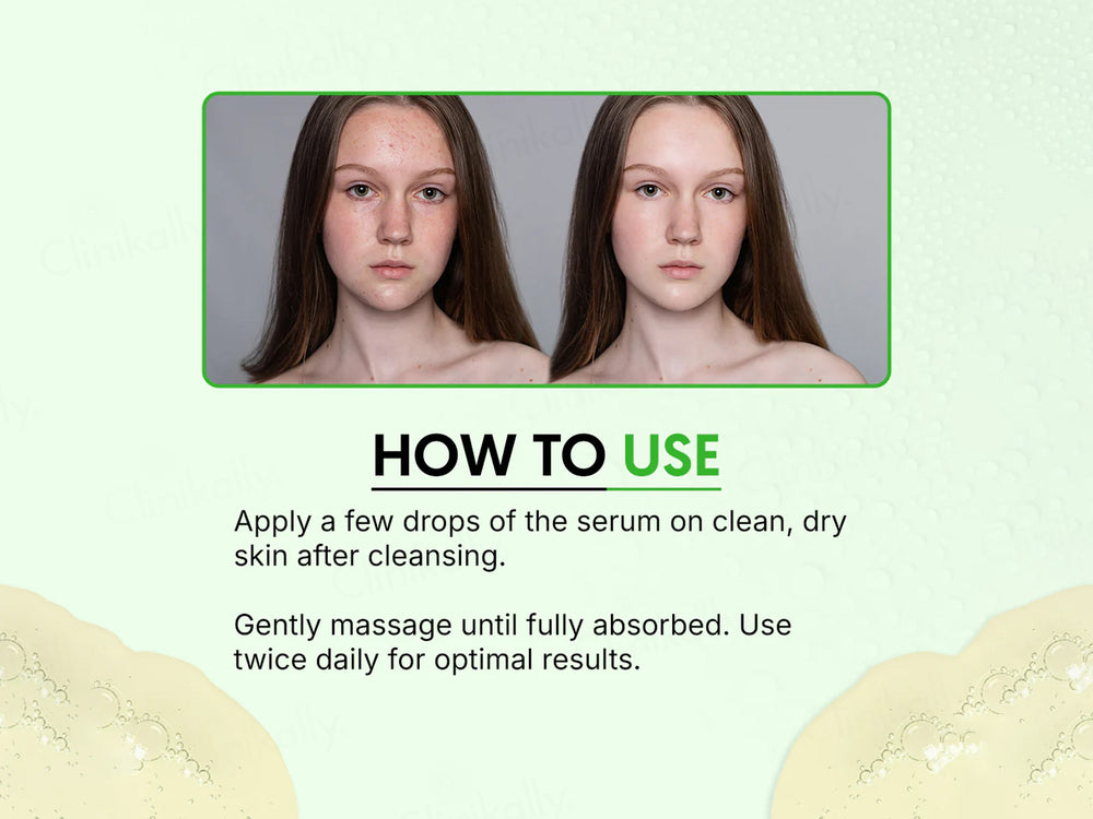 VRH AFS 7 Acne Face Serum