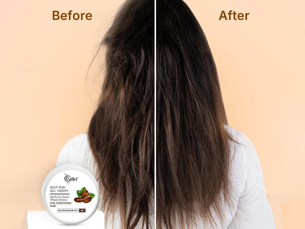 VRH Scalp Stem Cell Therapy Hair Conditioning Mask