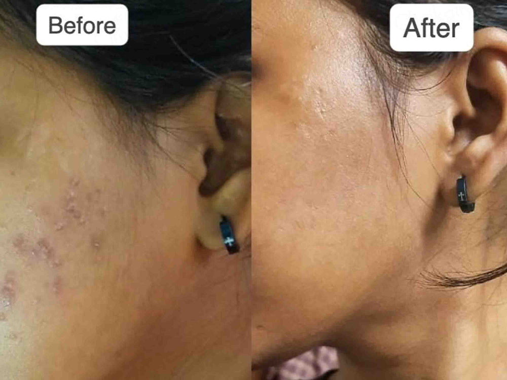 Vilvah Store Milk Drop Brightening Serum