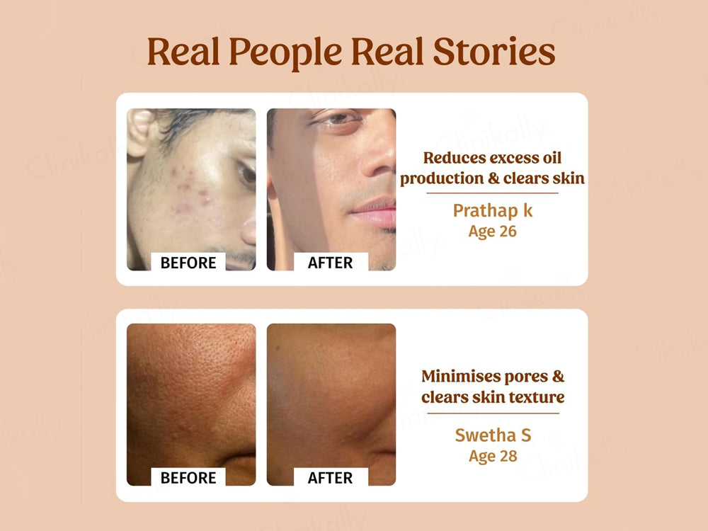 Vilvah Store Milk Facial Toner