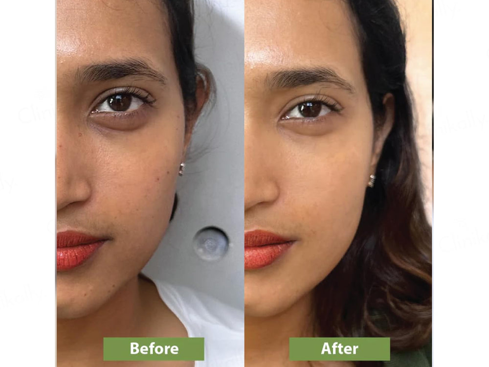 Vilvah Store Milk Mud Mask