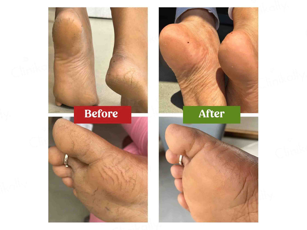 Vilvah Store Moisturizing Foot Cream