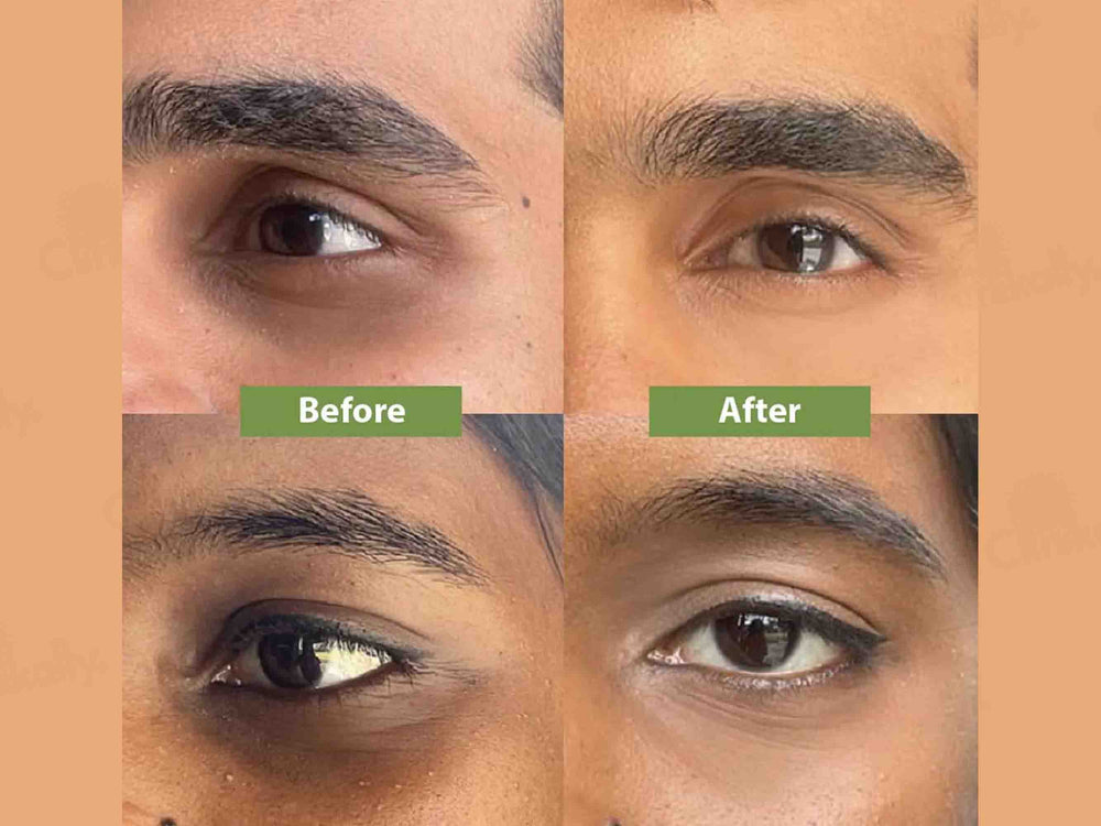 Vilvah Store Under Eye Cream For Dark Circle Control