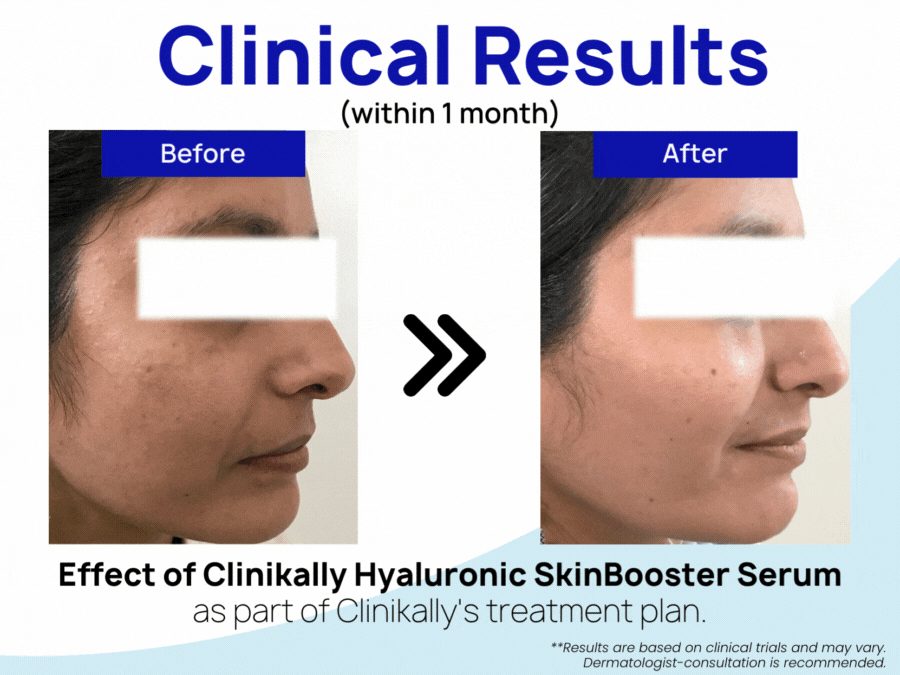 Clinikally Hyaluronic SkinBooster Serum