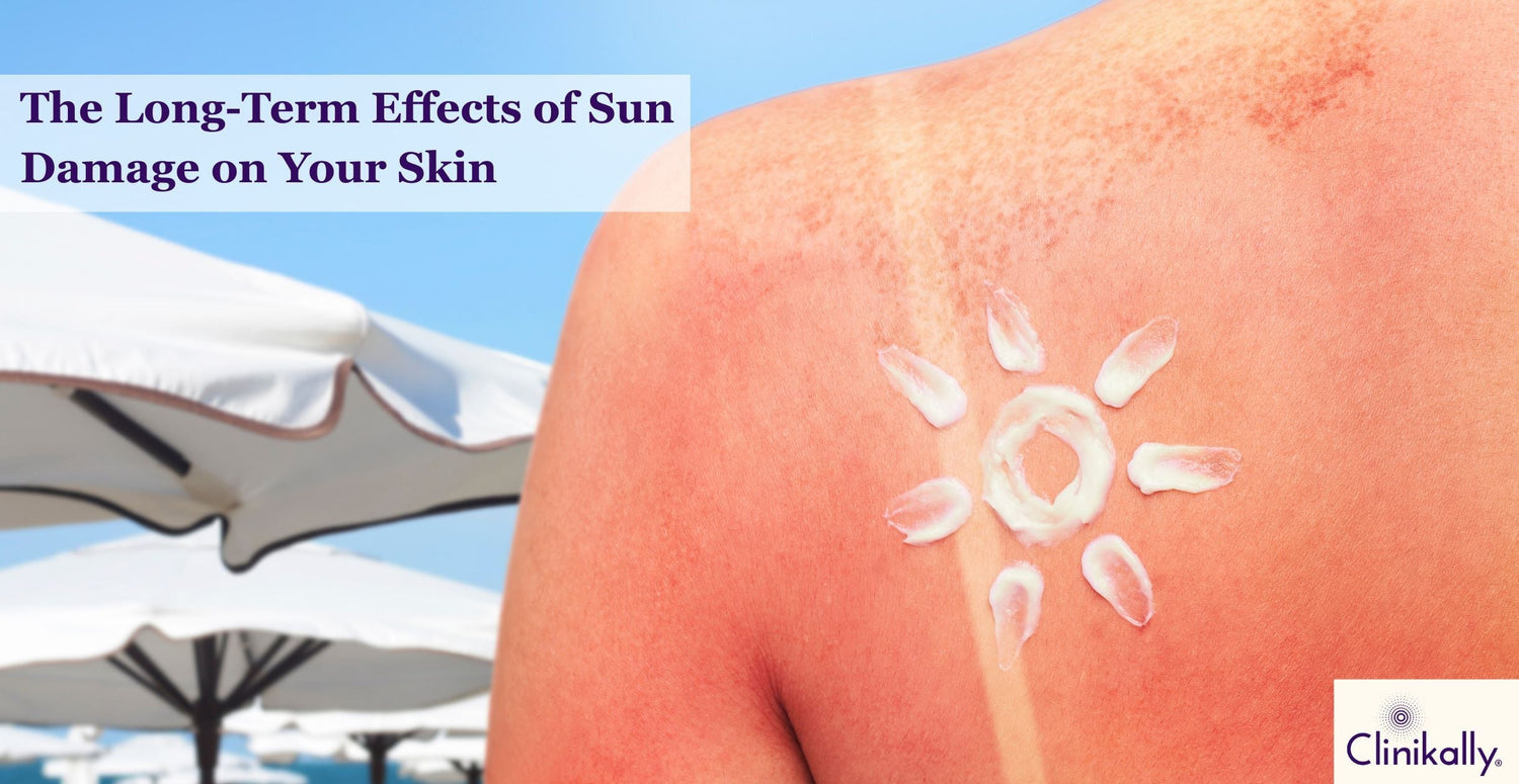 The Long-Term Effects of Sun Damage on Your Skin