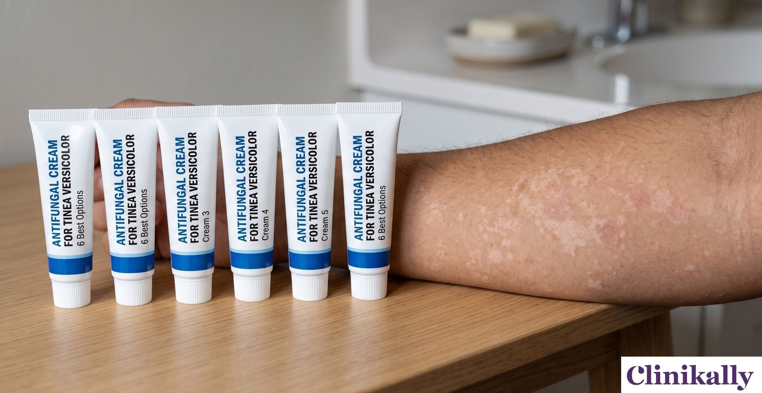 Antifungal creams for tinea versicolor skin patches