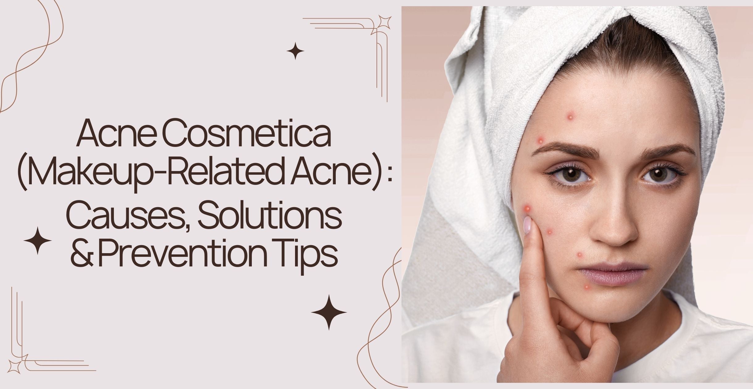Acne Cosmetica (Makeup-Related Acne): Causes, Solutions & Prevention Tips