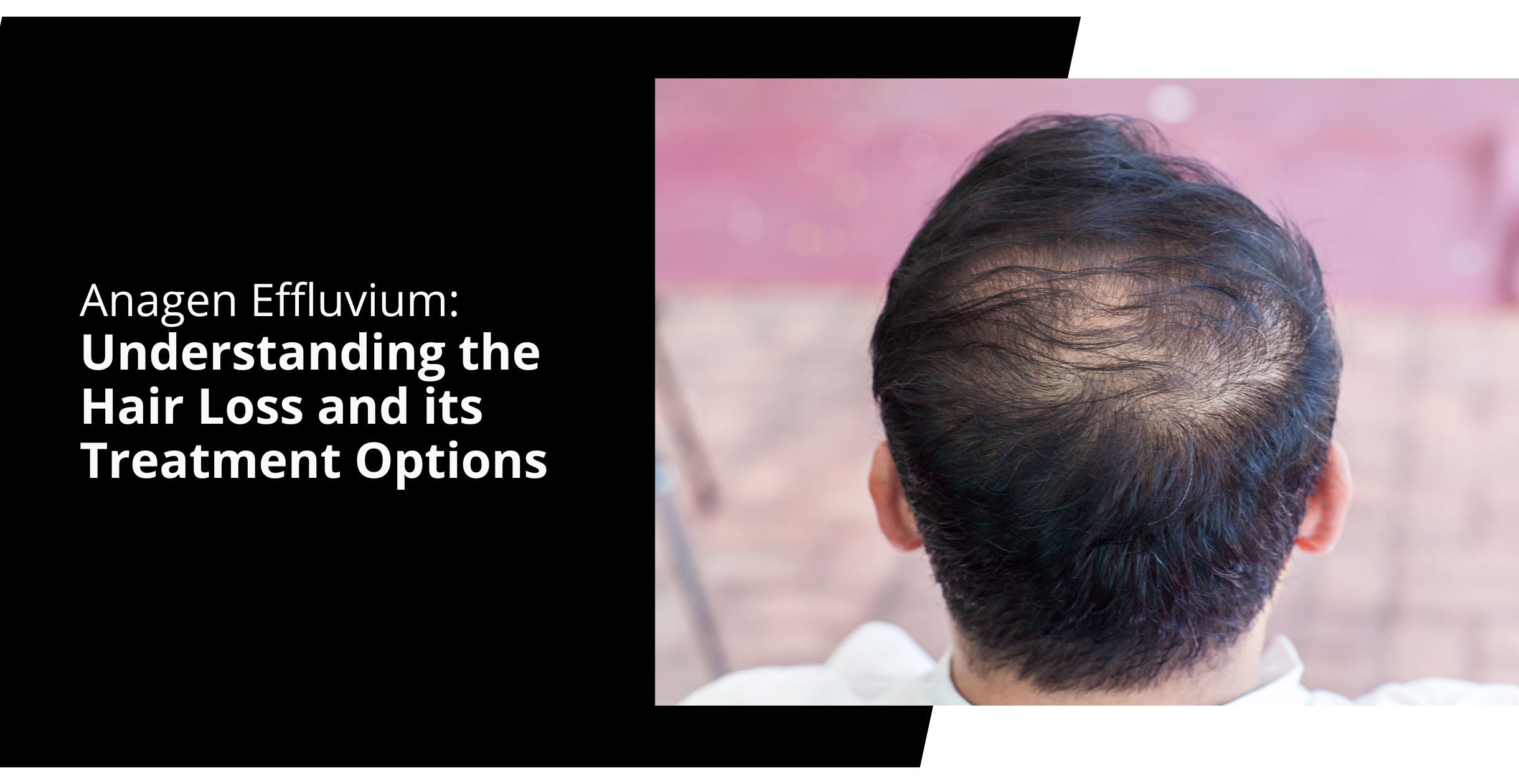 anagen effluvium treatment