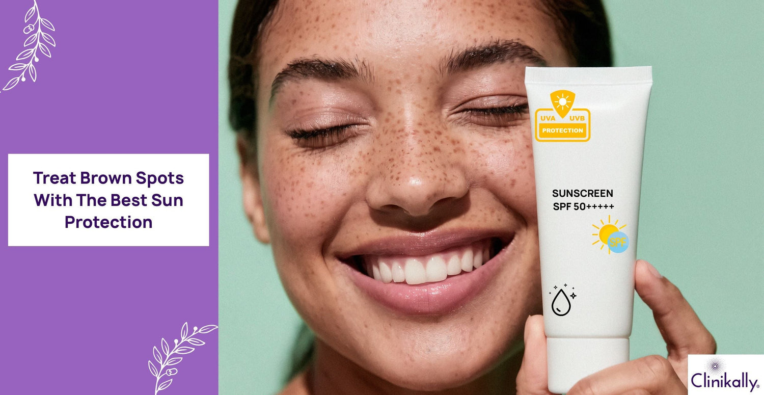 Treat Brown Spots With The Best Sun Protection