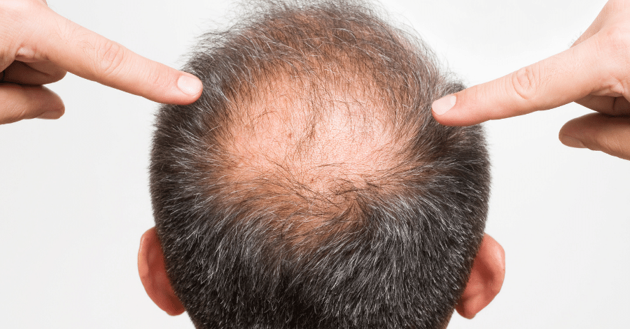 Bondi Boost Procapil Hair Tonic 125ml | OZ Hair & Beauty