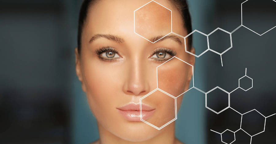 Remove dark spots with dark spot removal creams