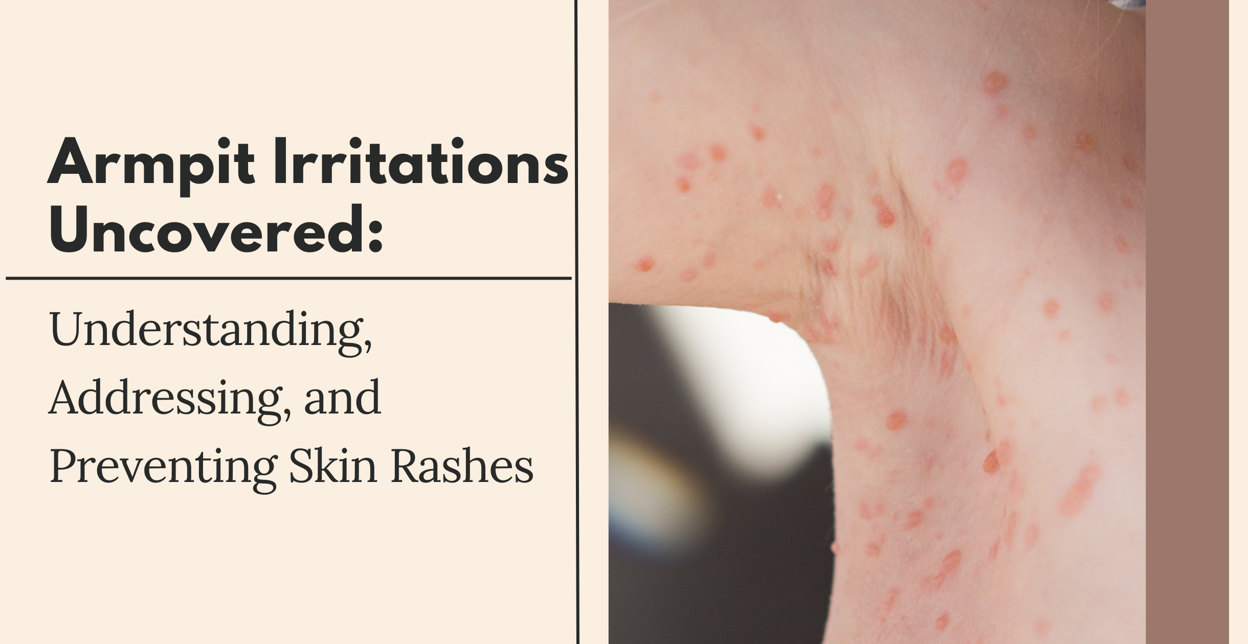 Baking Soda Armpit Rash